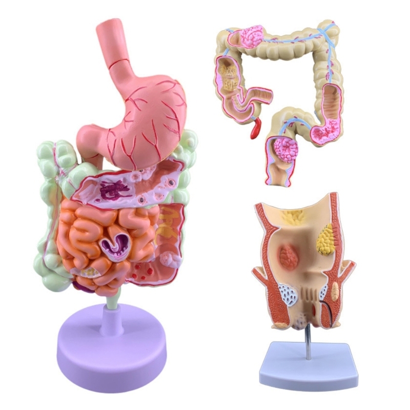 Q6PA 3D Pathologie-lesmodel, P - Medical Lab Observer recensie en prijs